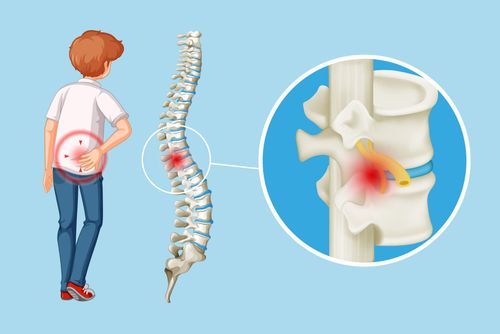 Symptom of Spinal Cord Injury - Its Causes and Treatments